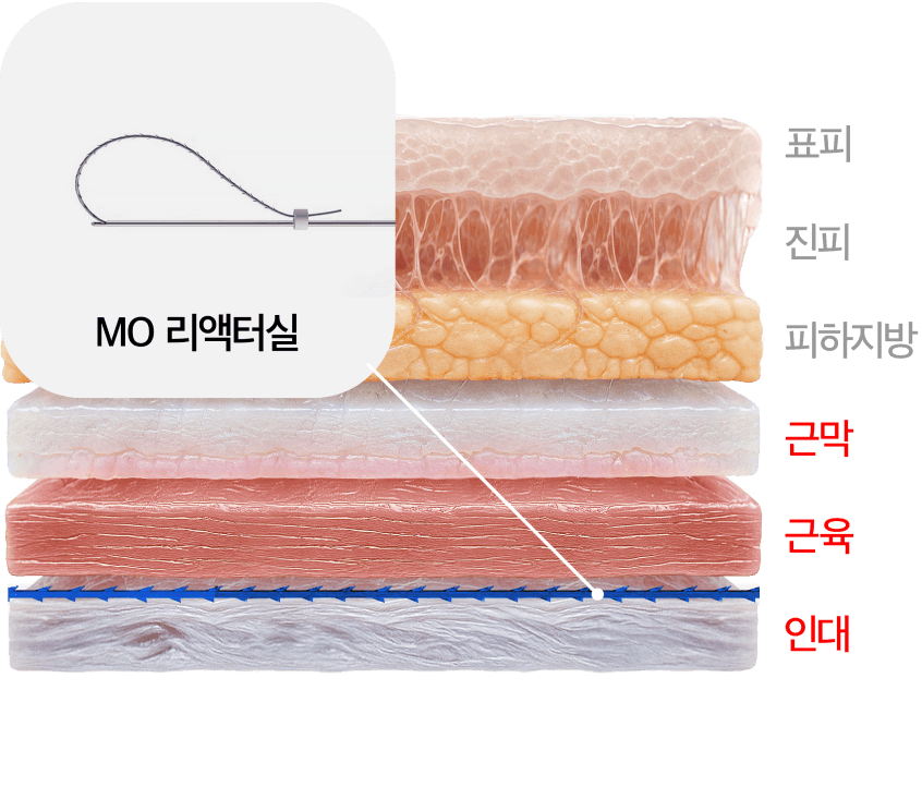 MO 리액터실 시술 층 단면도